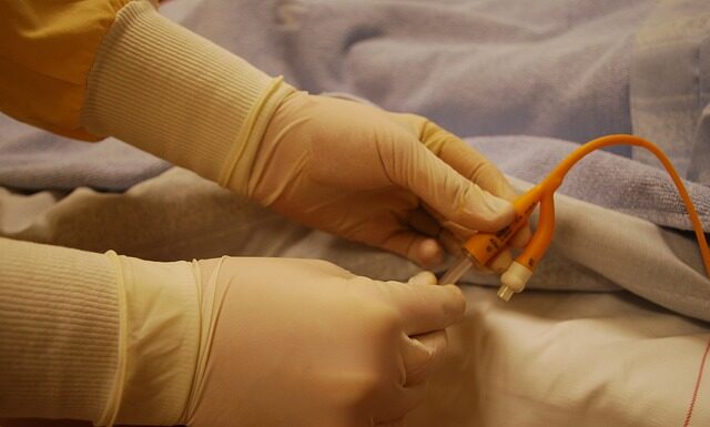 Czy konieczny jest cewnik przy cesarce? Czy konieczny jest cewnik przy cesarce?